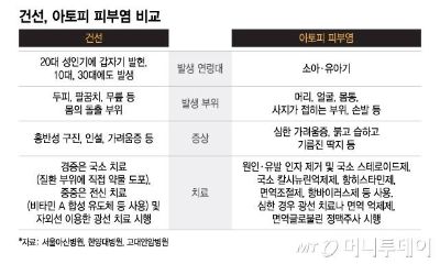 아토피인 줄 알았는데 비듬처럼 각질이…비슷한 듯 다른 '두 질환'